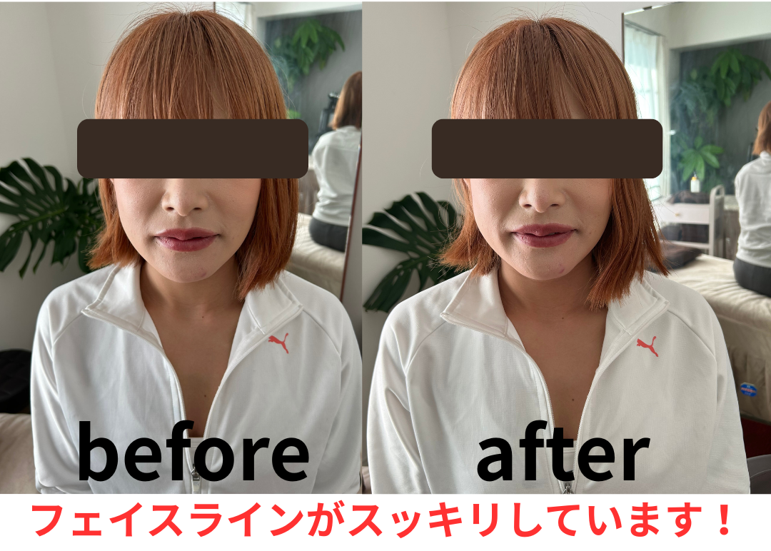 ビフォーアフター3